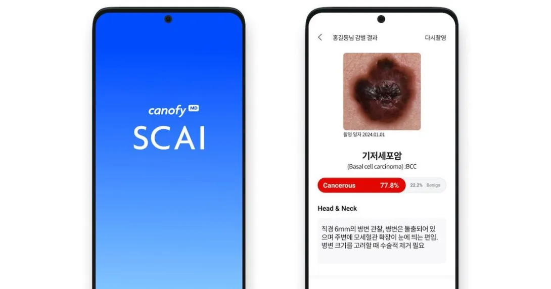 Mobile interface of LifeSemantics' canofyMD SCAI