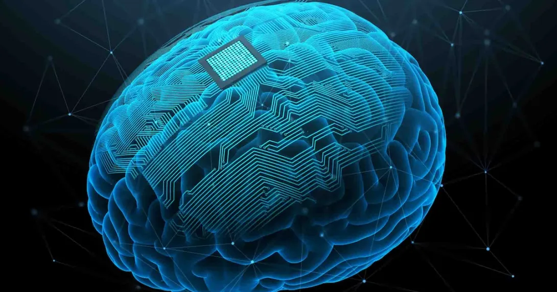 AI representation of a brain implant